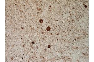 Immunohistochemistry (Paraffin-embedded Sections) (IHC (p)) image for anti-Neurofilament, Light Polypeptide (NEFL) (AA 1-284) antibody (ABIN1742358)