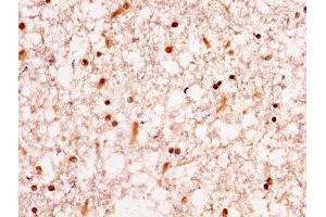 IHC image of ABIN7155098 diluted at 1:300 and staining in paraffin-embedded human brain tissue performed on a Leica BondTM system. (HNRNPA1 抗体  (AA 2-354))