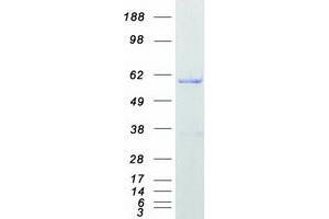 Validation with Western Blot
