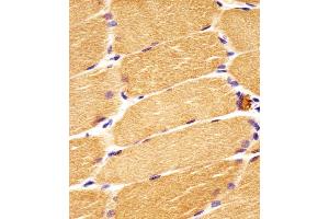Antibody staining DVL1 in human skeletal muscle sections by Immunohistochemistry (IHC-P - paraformaldehyde-fixed, paraffin-embedded sections). (DVL1 抗体  (AA 442-470))