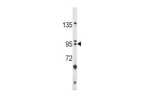 Western blot analysis of BICC1 Antibody (N-term) (ABIN390954 and ABIN2841144) in HL-60 cell line lysates (35 μg/lane). (BICC1 抗体  (N-Term))