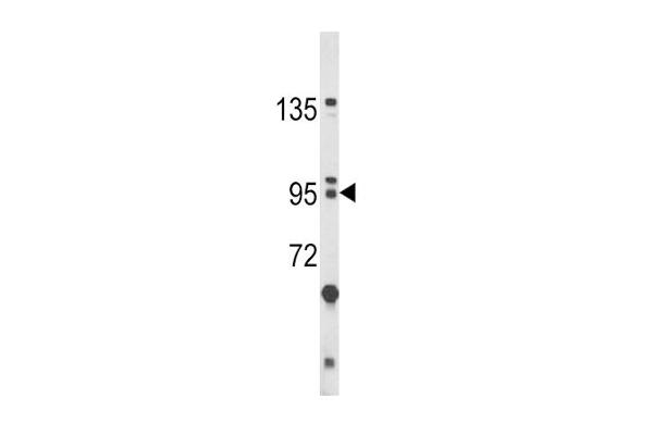 BICC1 抗体  (N-Term)