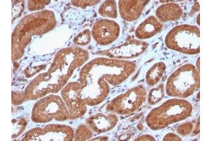 Formalin-fixed, paraffin-embedded human Kidney stained with MTAP Recombinant Rabbit Monoclonal Antibody (MTAP/3137R). (Recombinant MTAP 抗体  (AA 97-196))