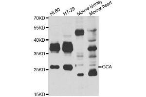 Western blot analysis of extracts of various cell lines, using GCA antibody. (Grancalcin 抗体)