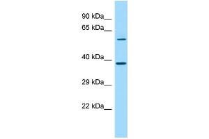 Western Blotting (WB) image for anti-SDA1 Domain Containing 1 (SDAD1) (C-Term) antibody (ABIN2790582) (SDAD1 抗体  (C-Term))
