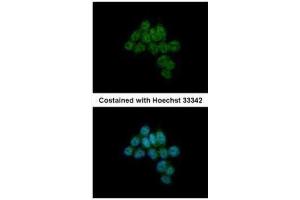 ICC/IF Image Immunofluorescence analysis of paraformaldehyde-fixed HCT116, using CREB3L1, antibody at 1:500 dilution. (CREB3L1 抗体  (C-Term))