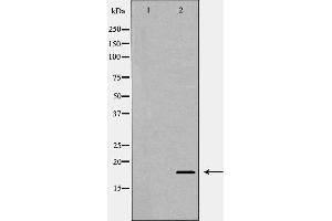 Western blot analysis of extracts of HEX-293, using MAX antibody. (MAX 抗体  (N-Term))