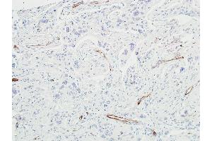 Immunohistochemistry (IHC) image for anti-Cadherin 5 (CDH5) (AA 48-599) antibody (ABIN7455190)