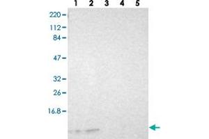 Western blot analysis of Lane 1: RT-4, Lane 2: U-251 MG, Lane 3: Human Plasma, Lane 4: Liver, Lane 5: Tonsil with RPS21 polyclonal antibody  at 1:250-1:500 dilution. (RPS21 抗体)