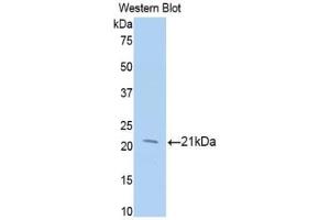 Western blot analysis of the recombinant protein. (MGEA5 抗体  (AA 271-438))