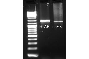 EndpointPCR with and without HotStart Antibody (Taq DNA Polymerase 抗体)