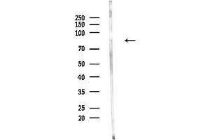 Western blot analysis of lysates from Hela cells(UV,30 min treatment), using Phospho-ATRIP (Ser224) Antibody at 1/1000 dilution.