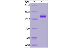 SDS-PAGE (SDS) image for Fibroblast Activation Protein, alpha (FAP) (AA 26-760) (Active) protein (Fc Tag) (ABIN7013469)