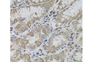 Immunohistochemistry of paraffin-embedded Human stomach using VIP Polyclonal Antibody (Vip 抗体)