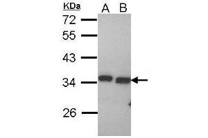 WB Image Sample (30 ug of whole cell lysate) A: Hela B: Hep G2 , 12% SDS PAGE antibody diluted at 1:1000 (PECR 抗体  (C-Term))
