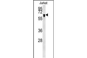 Western blot analysis in Jurkat cell line lysates (15ug/lane). (BTBD9 抗体  (AA 237-262))