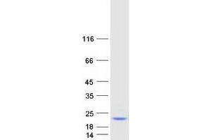 Western Blotting (WB) image for Prefoldin Subunit 4 (PFDN4) protein (Myc-DYKDDDDK Tag) (ABIN2728741)