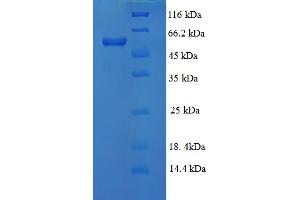 SDS-PAGE (SDS) image for Lysyl Oxidase-Like 1 (LOXL1) (AA 106-574), (partial) protein (His tag) (ABIN5709869) (LOXL1 Protein (AA 106-574, partial) (His tag))