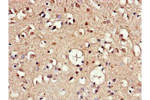 Immunohistochemistry of paraffin-embedded human brain tissue using ABIN7144390 at dilution of 1:100 (AAK1 抗体  (AA 274-465))