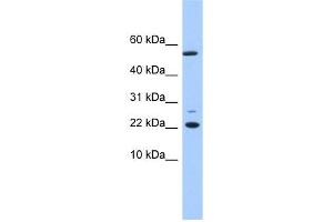 DPH4 antibody used at 1 ug/ml to detect target protein. (DNAJC24 抗体  (N-Term))
