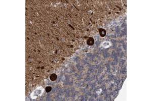 Immunohistochemical staining of human cerebellum with KCTD8 polyclonal antibody  shows strong cytoplasmic positivity in Purkinje cells at 1:20-1:50 dilution. (KCTD8 抗体)