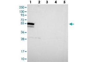 Western blot analysis of Lane 1: RT-4, Lane 2: U-251 MG, Lane 3: Human Plasma, Lane 4: Liver, Lane 5: Tonsil with DHX34 polyclonal antibody .