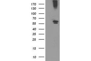 Western Blotting (WB) image for anti-Cytochrome P450, Family 2, Subfamily J, Polypeptide 2 (CYP2J2) antibody (ABIN1497731) (CYP2J2 抗体)