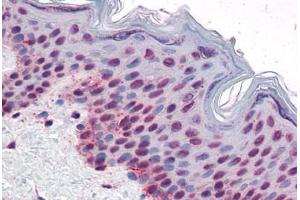 Skin: Formalin-Fixed, Paraffin-Embedded (FFPE) (Aurora Kinase B 抗体  (pThr232))