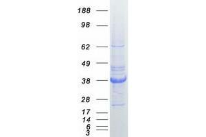 Validation with Western Blot