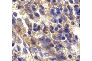 Immunohistochemistry of Bonzo in human spleen cells with Bonzo antibody at 20 μg/ml. (CXCR6 抗体  (N-Term))