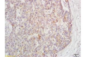 Immunohistochemistry (IHC) image for anti-Nuclear Receptor Subfamily 2, Group C, Member 2 (NR2C2) (pSer192) antibody (ABIN802023)