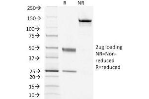 SDS-PAGE Analysis Purified TSHRB Monoclonal Antibody (TSHRB/1405). (TSH receptor 抗体)