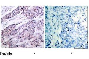 Image no. 1 for anti-B-Cell CLL/lymphoma 2 (BCL2) (AA 54-58) antibody (ABIN197202) (Bcl-2 抗体  (AA 54-58))