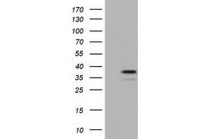 Western Blotting (WB) image for anti-E3 SUMO-Protein Ligase NSE2 (NSMCE2) antibody (ABIN1499526) (NSMCE2 抗体)