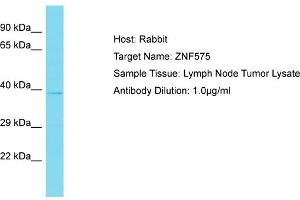 Host: Rabbit Target Name: ZNF575 Sample Tissue: Human Lymph Node Tumor Antibody Dilution: 1ug/ml (ZNF575 抗体  (Middle Region))