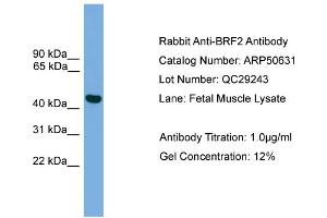 WB Suggested Anti-BRF2  Antibody Titration: 0. (BRF2 抗体  (Middle Region))