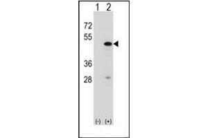 Western blot analysis of RBM22 (arrow) usingRBM22 Antibody .