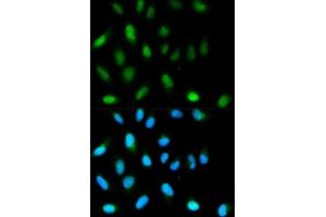 Immunofluorescence analysis of HeLa cells using CBX5 antibody. (CBX5 抗体)