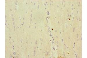 Immunohistochemistry of paraffin-embedded human heart tissue using ABIN7142250 at dilution of 1:100 (MRPS16 抗体  (AA 1-137))