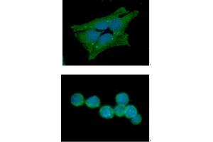 ICC/IF analysis of GSS in HeLa cells line, stained with DAPI (Blue) for nucleus staining and monoclonal anti-human GSS antibody (1:100) with goat anti-mouse IgG-Alexa fluor 488 conjugate (Green). (Glutathione Synthetase 抗体  (AA 1-474))