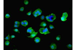 Immunofluorescent analysis of MCF-7 cells using ABIN7142610 at dilution of 1:100 and Alexa Fluor 488-congugated AffiniPure Goat Anti-Rabbit IgG(H+L) (MTHFS 抗体  (AA 2-203))