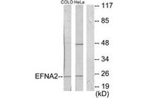 Western blot analysis of extracts from HeLa/COLO205 cells, using EFNA2 Antibody. (Ephrin A2 抗体  (AA 1-50))