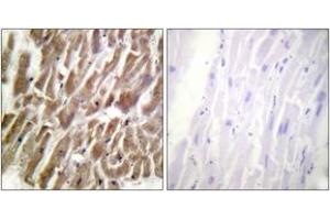 Immunohistochemistry (IHC) image for anti-Cardiac Troponin I (TNNI3) (AA 11-60) antibody (ABIN2888778) (TNNI3 抗体  (AA 11-60))