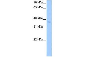 Western Blot showing hCG_1982709 antibody used at a concentration of 1-2 ug/ml to detect its target protein. (hCG_1982709 (N-Term) 抗体)