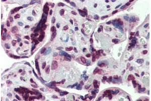 Human Placenta: Formalin-Fixed, Paraffin-Embedded (FFPE) (SHROOM2 抗体  (AA 1554-1616))