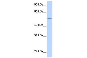 UGT1A1 antibody used at 1 ug/ml to detect target protein. (UGT1A1 抗体  (N-Term))