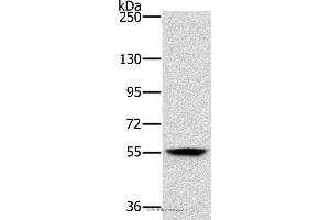 Western blot analysis of Mouse skin tissue, using LOXL1 Polyclonal Antibody at dilution of 1:200 (LOXL1 抗体)