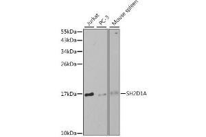 Western blot analysis of extracts of various cell lines, using SH2D1A antibody. (SH2D1A 抗体)