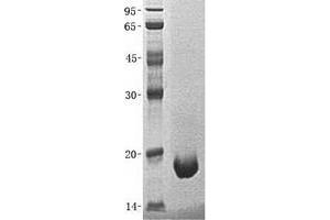 Validation with Western Blot (SCO1 Protein (His tag))