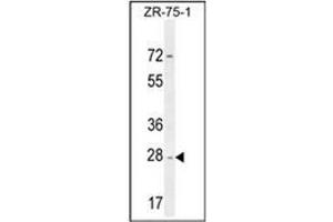 Western Blotting (WB) image for anti-NADH Dehydrogenase (Ubiquinone) 1 alpha Subcomplex, Assembly Factor 1 (NDUFAF1) (AA 250-280), (C-Term) antibody (ABIN953630)